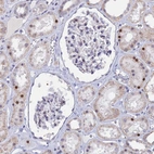 Immunohistochemical staining of human kidney shows moderate nuclear positivity in subset of cells in tubules.