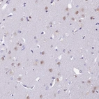 Immunohistochemical staining of human cerebral cortex shows weak nuclear positivity in neurons.