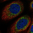 Immunofluorescent staining of human cell line A-431 shows positivity in mitochondria.