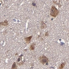 Immunohistochemical staining of human cerebral cortex using Anti-CARS antibody HPA002383.