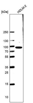 Western blot analysis in human cell line HDLM-2.