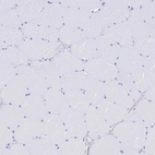 Immunohistochemical staining of human skeletal muscle shows no positivity in myocytes as expected.