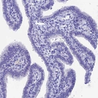 Immunohistochemical staining of human fallopian tube shows no positivity in glandular cells.