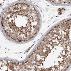 Immunohistochemical staining of human testis shows strong positivity in nuclear membrane in cells in seminiferous ducts in addition to moderate cytoplasmic and nucleoli positivity.