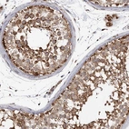 Immunohistochemical staining of human testis shows strong positivity in nuclear membrane in cells in seminiferous ducts in addition to moderate cytoplasmic and nucleoli positivity.