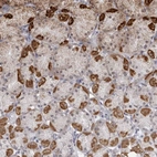 Immunohistochemical staining of human stomach shows moderate positivity in nucleoli/nucleus in glandular cells and strong cytoplasmic positivity in chief cells.