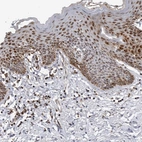 Immunohistochemical staining of human skin shows strong positivity in nucleoli in squamous epithelial cell in addition to cytoplasmic positivity.