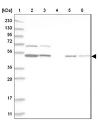 Lane 1: Marker [kDa] 230, 130, 95, 72, 56, 36, 28, 17, 11_br/_Lane 2: Human cell line RT-4_br/_Lane 3: Human cell line U-251MG sp_br/_Lane 4: Human plasma (IgG/HSA depleted)_br/_Lane 5: Human liver tissue_br/_Lane 6: Human tonsil tissue