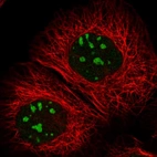Immunofluorescent staining of human cell line A-431 shows localization to nucleus & nucleoli.