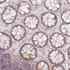 Immunohistochemical staining of human colon shows weak cytoplasmic positivity in glandular cells.