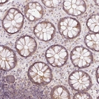 Immunohistochemical staining of human colon shows weak cytoplasmic positivity in glandular cells.