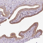 Immunohistochemical staining of human fallopian tube shows moderate cytoplasmic positivity in glandular cells.