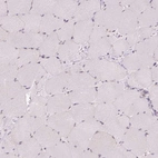 Immunohistochemical staining of human skeletal muscle shows no positivity in myocytes.
