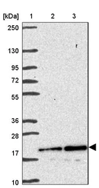 Lane 1: Marker [kDa] 250, 130, 95, 72, 55, 36, 28, 17, 10_br/_Lane 2: Human cell line RT-4_br/_Lane 3: Human cell line U-251MG sp