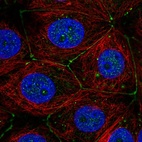 Anti-PLXNA3 Antibody