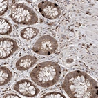 Immunohistochemical staining of human rectum shows moderate cytoplasmic positivity in glandular cells and strong cytoplasmic positivity in subset of endocrine cells.