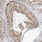 Immunohistochemical staining of human testis shows moderate cytoplasmic positivity and moderate nuclear positivity in cells in seminiferous ducts.