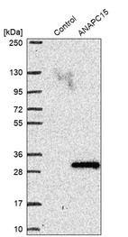 Western blot analysis in control (vector only transfected HEK293T lysate) and ANAPC15 over-expression lysate (Co-expressed with a C-terminal myc-DDK tag (~3.1 kDa) in mammalian HEK293T cells, LY415516).