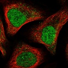 Immunofluorescent staining of human cell line U-2 OS shows localization to nucleoplasm & vesicles.