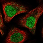 Immunofluorescent staining of human cell line U-2 OS shows localization to nucleoplasm & vesicles.