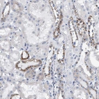 Immunohistochemical staining of human kidney shows strong cytoplasmic granular positivity in subset of cells in tubules.