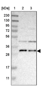 Lane 1: Marker [kDa] 230, 130, 95, 72, 56, 36, 28, 17, 11_br/_Lane 2: Human cell line RT-4_br/_Lane 3: Human cell line U-251MG sp