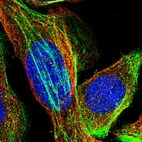 Immunofluorescent staining of human cell line U-2 OS shows localization to actin filaments.