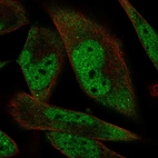 Immunofluorescent staining of human cell line RH-30 shows localization to nucleoplasm & cytosol.