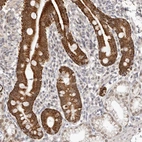 Immunohistochemical staining of human duodenum shows strong cytoplasmic positivity in glandular cells.