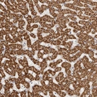 Immunohistochemical staining of human liver shows strong cytoplasmic positivity in hepatocytes.