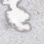 Immunohistochemical staining of human prostate shows weak nuclear/nuclear membranous positivity in glandular cells.
