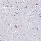 Immunohistochemical staining of human cerebral cortex shows moderate cytoplasmic positivity in neurons.