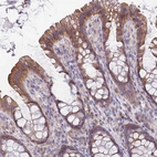 Immunohistochemical staining of human colon shows moderate cytoplasmic positivity in glandular cells.