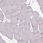 Immunohistochemical staining of human skeletal muscle shows no positivity in myocytes as expected.