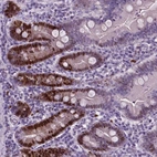 Immunohistochemical staining of human duodenum shows strong nuclear positivity in glandular cells.