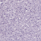 Immunohistochemical staining of human liver shows no positivity in hepatocytes.