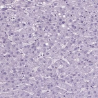 Immunohistochemical staining of human liver shows no positivity in hepatocytes.