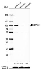 Western blot analysis in U2OS cells transfected with control siRNA, target specific siRNA probe #1 and #2, using Anti-NCAPH2 antibody. Remaining relative intensity is presented. Loading control: Anti-GAPDH.