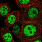 Immunofluorescent staining of human cell line MCF7 shows localization to nucleoplasm & cell junctions.