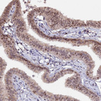 Immunohistochemical staining of human fallopian tube shows moderate nuclear positivity in glandular cells.