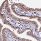 Immunohistochemical staining of human fallopian tube shows moderate nuclear positivity in glandular cells.