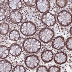 Immunohistochemical staining of human colon shows strong nuclear positivity in glandular cells and lymphoid cells.