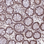 Immunohistochemical staining of human colon shows strong nuclear positivity in glandular cells and lymphoid cells.