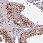 Immunohistochemical staining of human testis shows strong nuclear positivity in cells in seminiferous ducts.
