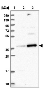Lane 1: Marker [kDa] 250, 130, 95, 72, 55, 36, 28, 17, 10_br/_Lane 2: Human cell line RT-4_br/_Lane 3: Human cell line U-251MG sp