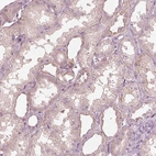 Immunohistochemical staining of human kidney shows weak cytoplasmic positivity in cells in tubules.