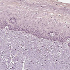 Immunohistochemical staining of human cervix, uterine shows no positivity in squamous epithelial cells.