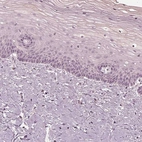 Immunohistochemical staining of human cervix, uterine shows no positivity in squamous epithelial cells.