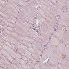 Immunohistochemical staining of human skeletal muscle shows no positivity in myocytes as expected.