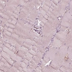 Immunohistochemical staining of human skeletal muscle shows no positivity in myocytes as expected.